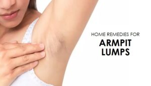 Home Remedies for Armpit Lumps - Enjoy